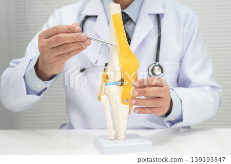 Osteoarthritis of the knee, Doctor holding human knee joint orthopedic anatomy model in hospital. Osteoarthritis of the knee, Doctor holding human knee joint orthopedic anatomy model in hospital. 139193847