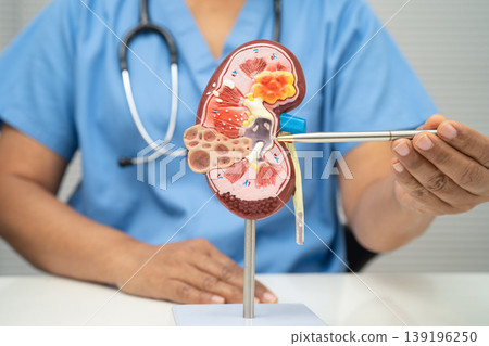 Chronic kidney disease, doctor with model for treatment urinary system, urology, Estimated glomerular filtration rate eGFR. Chronic kidney disease, doctor with model for treatment urinary system, urology, Estimated glomerular filtration rate eGFR. 139196250