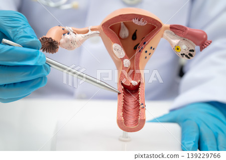Uterus, doctor holding human anatomy model for study diagnosis and treatment in hospital. 139229766
