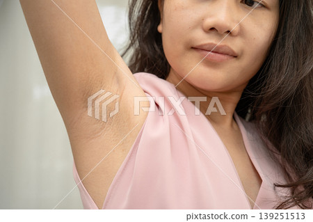 Asian woman have problem black armpit beauty skin care. Asian woman have problem black armpit beauty skin care. 139251513
