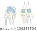 An illustration showing the knee joint and ligaments from the front and back, along with the names of each part. 139263504