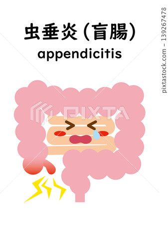 大腸闌尾炎(角色) 大腸闌尾炎(角色) 139267478