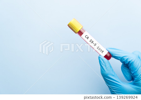 Doctor holding a test blood sample tube with CA 19-9 test, tumor marker for pancreatic and stomach cancers. 139269924