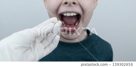 10 year old boy at pediatric dentist showing milk tooth extraction. Concept of caries treatment, physiological change of teeth and permanent teeth eruption in school age children. 10 year old boy at pediatric dentist showing milk tooth extraction. Concept of caries treatment, physiological change of teeth and permanent teeth eruption in school age children. 139302658