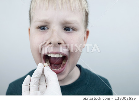 10 year old boy at pediatric dentist showing milk tooth extraction. Concept of caries treatment, physiological change of teeth and permanent teeth eruption in school age children. 10 year old boy at pediatric dentist showing milk tooth extraction. Concept of caries treatment, physiological change of teeth and permanent teeth eruption in school age children. 139302659