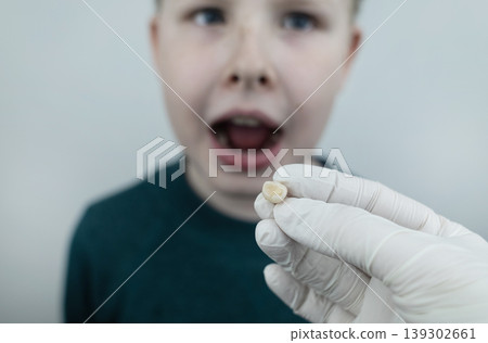 10 year old boy at pediatric dentist showing milk tooth extraction. Concept of caries treatment, physiological change of teeth and permanent teeth eruption in school age children. 10 year old boy at pediatric dentist showing milk tooth extraction. Concept of caries treatment, physiological change of teeth and permanent teeth eruption in school age children. 139302661