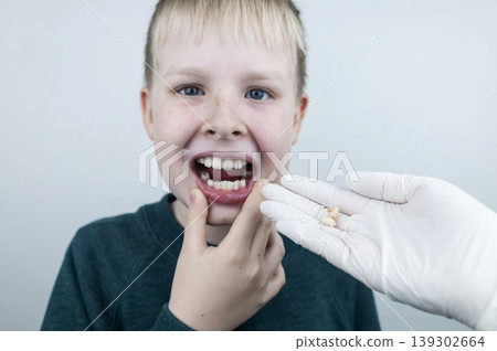 10 year old boy at pediatric dentist showing milk tooth extraction. Concept of caries treatment, physiological change of teeth and permanent teeth eruption in school age children. 10 year old boy at pediatric dentist showing milk tooth extraction. Concept of caries treatment, physiological change of teeth and permanent teeth eruption in school age children. 139302664