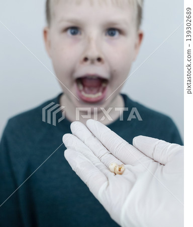 10 year old boy at pediatric dentist showing milk tooth extraction. Concept of caries treatment, physiological change of teeth and permanent teeth eruption in school age children. 10 year old boy at pediatric dentist showing milk tooth extraction. Concept of caries treatment, physiological change of teeth and permanent teeth eruption in school age children. 139302689