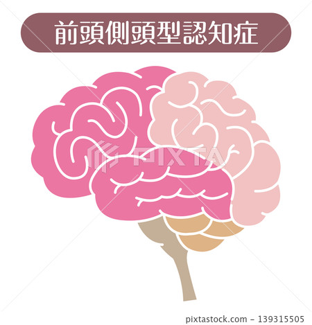 額顳葉失智症：大腦示意圖（無線條） 139315505