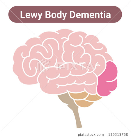 Lewy body dementia: Brain illustration (without lines) Lewy body dementia: Brain illustration (without lines) 139315768