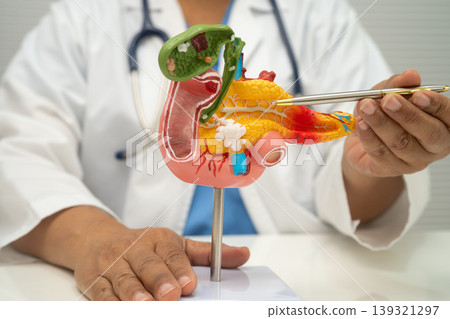 Pancreatitis, pancreatic cancer, Asian doctor with pancreas, gallbladder and bile duct human anatomy model at hospital. Pancreatitis, pancreatic cancer, Asian doctor with pancreas, gallbladder and bile duct human anatomy model at hospital. 139321297