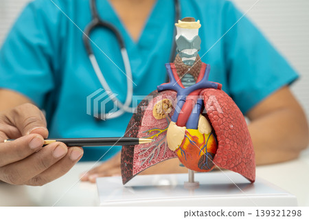 Pneumonia, lung cancer, Asian doctor holding human model. Pneumonia, lung cancer, Asian doctor holding human model. 139321298