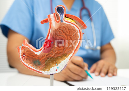 Stomach disease, doctor holding anatomy model for study diagnosis and treatment in hospital. 139322317