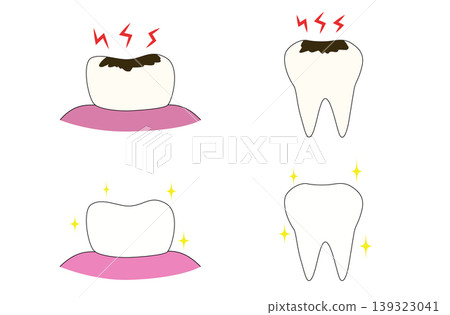 蛀牙和健康牙齒 139323041