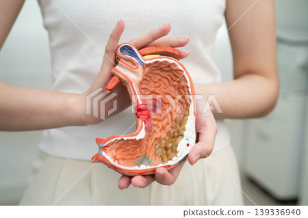 Stomach disease, Asian woman holding anatomy model for study diagnosis and treatment in hospital. 139336940