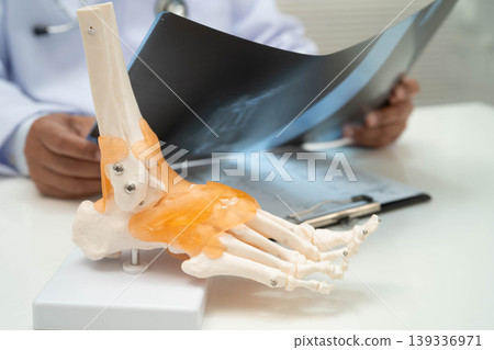 Doctor examining foot ankle joint bone radiography xray film. Doctor examining foot ankle joint bone radiography xray film. 139336971