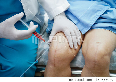Doctor checking Asian elderly woman patient with scar knee replacement surgery in hospital. 139336989