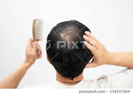 Bald in the middle head and begin no loss hair glabrous of mature man with comb. Bald in the middle head and begin no loss hair glabrous of mature man with comb. 139337004
