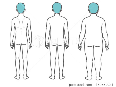 Illustrations comparing the body types of adult men (a set of three types: thin, average, and obese, viewed from behind) Illustrations comparing the body types of adult men (a set of three types: thin, average, and obese, viewed from behind) 139339981