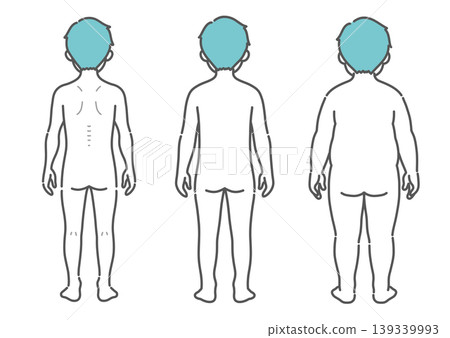 男孩體型對比圖（瘦弱、中等、肥胖 - 背面視角） 139339993