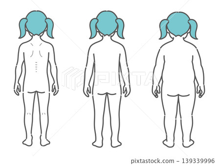 對比女孩體型的插圖（3種類型：瘦、中等、肥胖 - 背面圖） 139339996