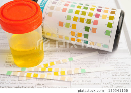 Urinalysis, urine cup with reagent strip pH paper test and comparison chart in laboratory. Urinalysis, urine cup with reagent strip pH paper test and comparison chart in laboratory. 139341166