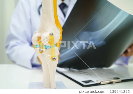 Doctor examining knee joint bone radiography xray film. 139341235