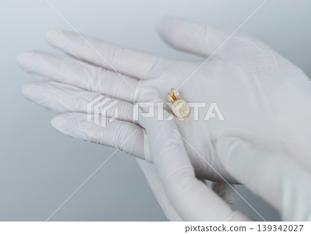 Pediatric dentist in white gloves holding extracted primary milk teeth. Concept of deciduous tooth loss, dental extraction procedure and childhood healthcare. 139342027