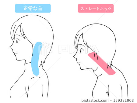 Explanation of a normal neck and a straight neck. 139351908