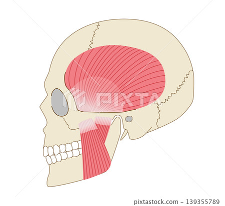 Anatomical diagram of the skull and masticatory muscles (temporalis and masseter muscles) viewed from the side. 139355789