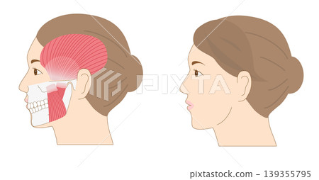 A set of anatomical illustrations comparing a woman's profile with the bones and muscles of her lower jaw. A set of anatomical illustrations comparing a woman's profile with the bones and muscles of her lower jaw. 139355795