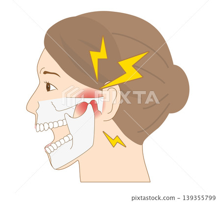 一位患有顎骨疼痛的女性的側臉：顳顎關節障礙解剖圖 139355799