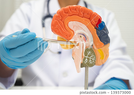 Alzheimer disease, Asian doctor holding brain anatomy model for study diagnosis and treatment in hospital. Alzheimer disease, Asian doctor holding brain anatomy model for study diagnosis and treatment in hospital. 139373000