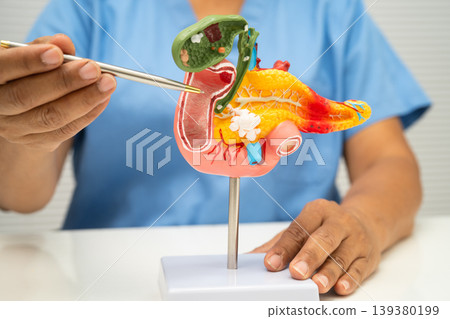 Pancreatitis, pancreatic cancer, Asian doctor with pancreas, gallbladder and bile duct human anatomy model at hospital. Pancreatitis, pancreatic cancer, Asian doctor with pancreas, gallbladder and bile duct human anatomy model at hospital. 139380199