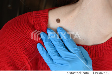 Dermatologist with magnifying glass examining moles of young woman on grey background with space for text, closeup 139387569