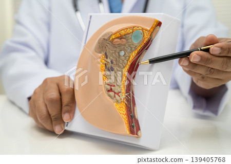 doctor holding female breast human anatomy model. doctor holding female breast human anatomy model. 139405768