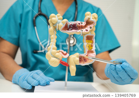 Intestine, appendix and digestive system, doctor holding anatomy model for study diagnosis and treatment in hospital. Intestine, appendix and digestive system, doctor holding anatomy model for study diagnosis and treatment in hospital. 139405769