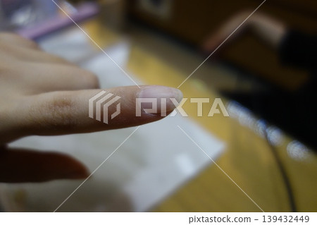 Close-up of a Finger Nail Detail Close-up of a Finger Nail Detail 139432449