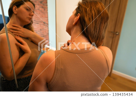 The girl looks at the pimples on her neck in the mirror. 139435434
