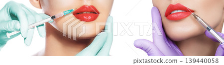 Set sensual lip with syringe. Injection into lip for augmentation Set sensual lip with syringe. Injection into lip for augmentation 139440058