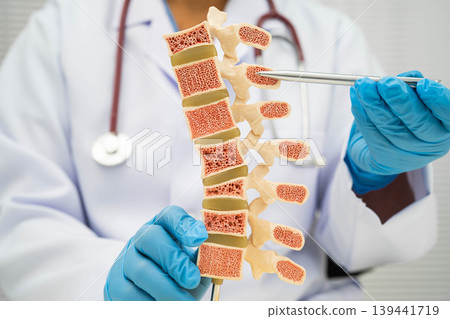 Doctor holding osteoporosis in back bone model for treatment medical in orthopedic department. Doctor holding osteoporosis in back bone model for treatment medical in orthopedic department. 139441719