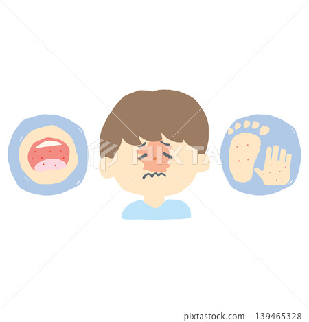 Illustrations of Hand, Foot, and Mouth Disease Symptoms: Rash on Children's Hands and Feet and Fever (For Kindergartens, Daycares, and Pediatricians) 139465328