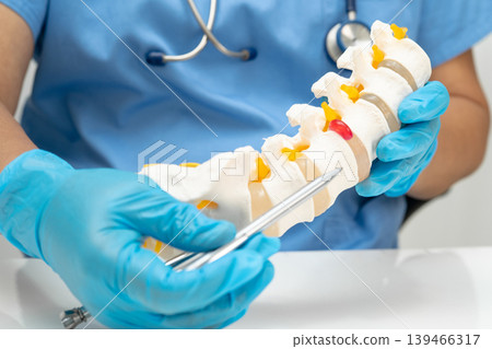 Asian doctor holding spinal nerve and bone model, Lumbar spine displaced herniated disc fragment for treatment medical in the orthopedic department. 139466317