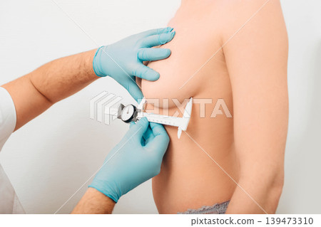 Plastic surgeon marks woman breast for installing breast silicone implant. Cosmetic breast surgery. Plastic surgeon marks woman breast for installing breast silicone implant. Cosmetic breast surgery. 139473310