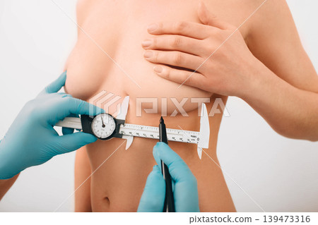 Plastic surgeon marks woman breast for installing breast silicone implant. Cosmetic breast surgery. Plastic surgeon marks woman breast for installing breast silicone implant. Cosmetic breast surgery. 139473316