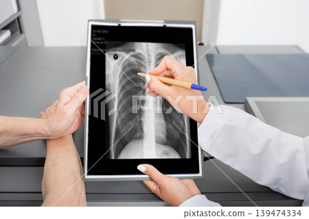 Pulmonologist showing an old patient an X-ray image of her lungs. Prevention and treatment of lung disease, pneumonia, coronavirus 139474334