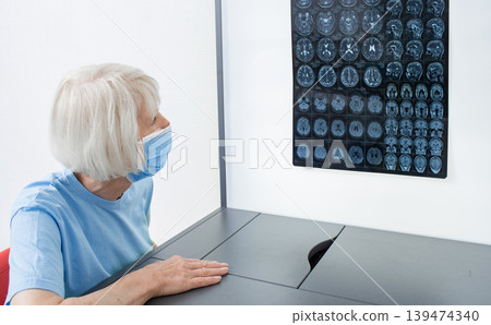 Elderly woman patient wearing a medical mask looks at the results of an MRI scan of her brain. Diagnosis of diseases and head injuries. DIAGNOSTICS OF HEAD TUMOR 139474340