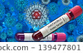 Blood test with Hantavirus in the background. HANTAVIRUS Andes variant 139477801