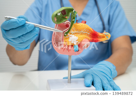 Pancreatitis, pancreatic cancer, Asian doctor with pancreas, gallbladder and bile duct human anatomy model at hospital. Pancreatitis, pancreatic cancer, Asian doctor with pancreas, gallbladder and bile duct human anatomy model at hospital. 139489872