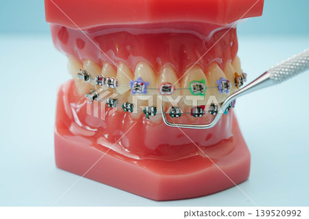 Dentist equipment, dental instrument, tools for dental professionals use to provide dental treatment. Dentist equipment, dental instrument, tools for dental professionals use to provide dental treatment. 139520992